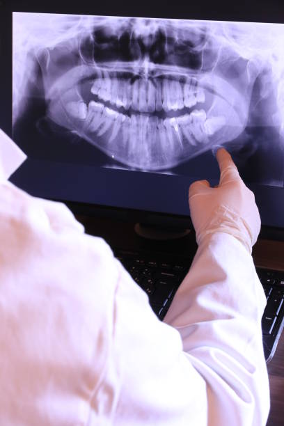 Best Emergency Treatment for Dental Infections or Abscesses in Utica, NE
